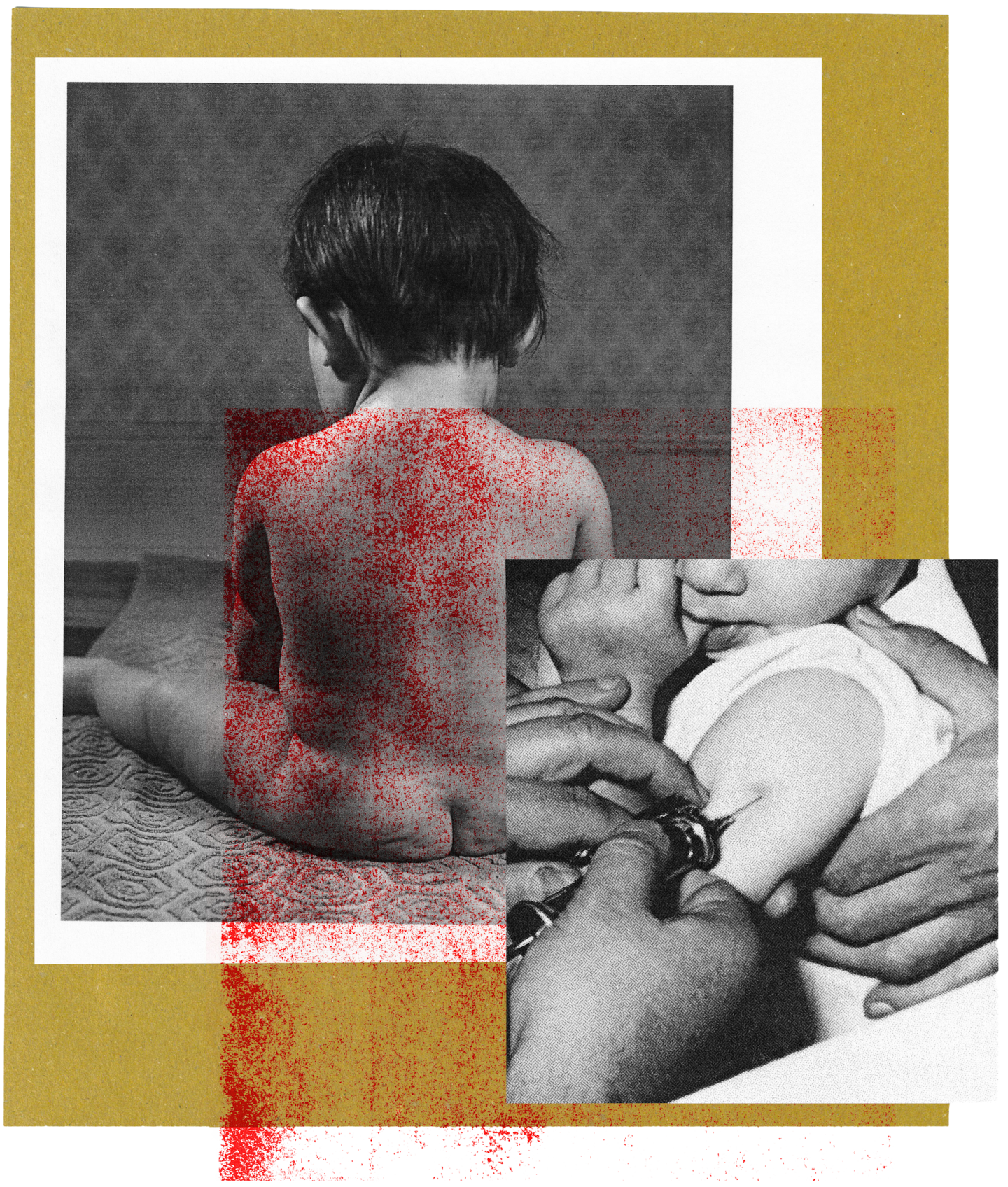 Measles outbreaks are back: how the vaccine against the childhood disease once came to the Netherlands [Translated]